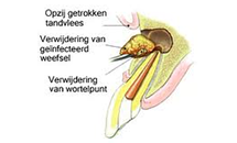 Root 1 Root 1